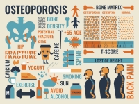 Osteoporosis Chart 2019